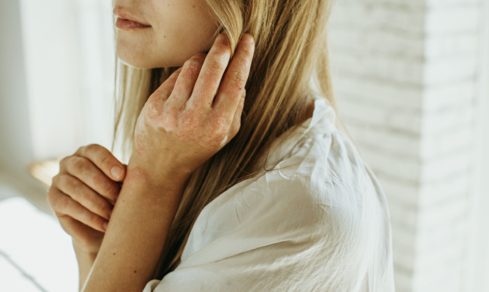 london chronic illness homeopathy